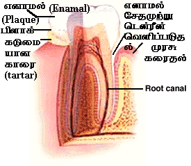 பொதுவாக எமது பற்களின் மேற்புறம் எனாமல் எனப்படுவது கடினமானது. எமது உடலின் மிகக் கடுமையான பகுதி இதுதான். உணர்வற்றது அதனால் வலி தெரிவதில்லை.